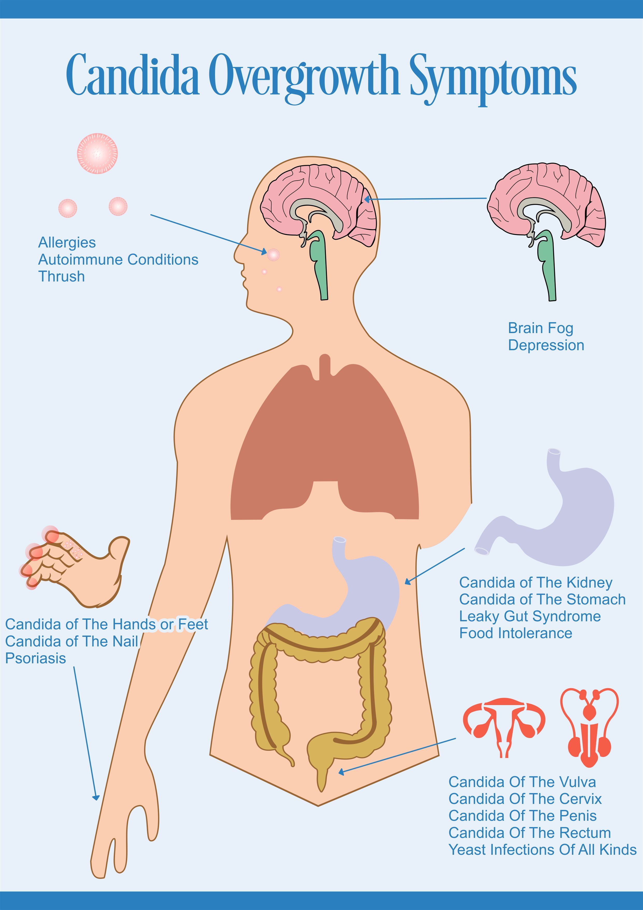 Candida overgrowth symptoms